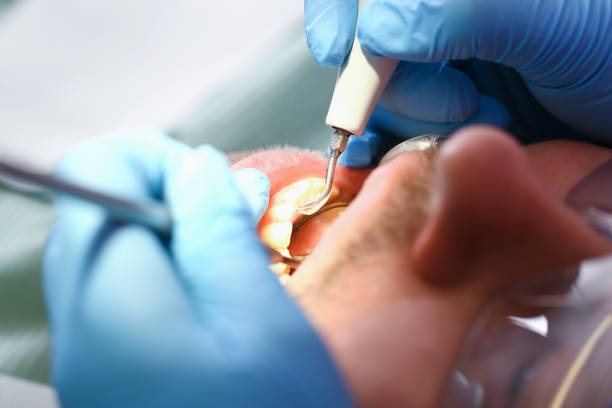 Best Emergency Tooth Extraction  in Hide A Way Lake, MS